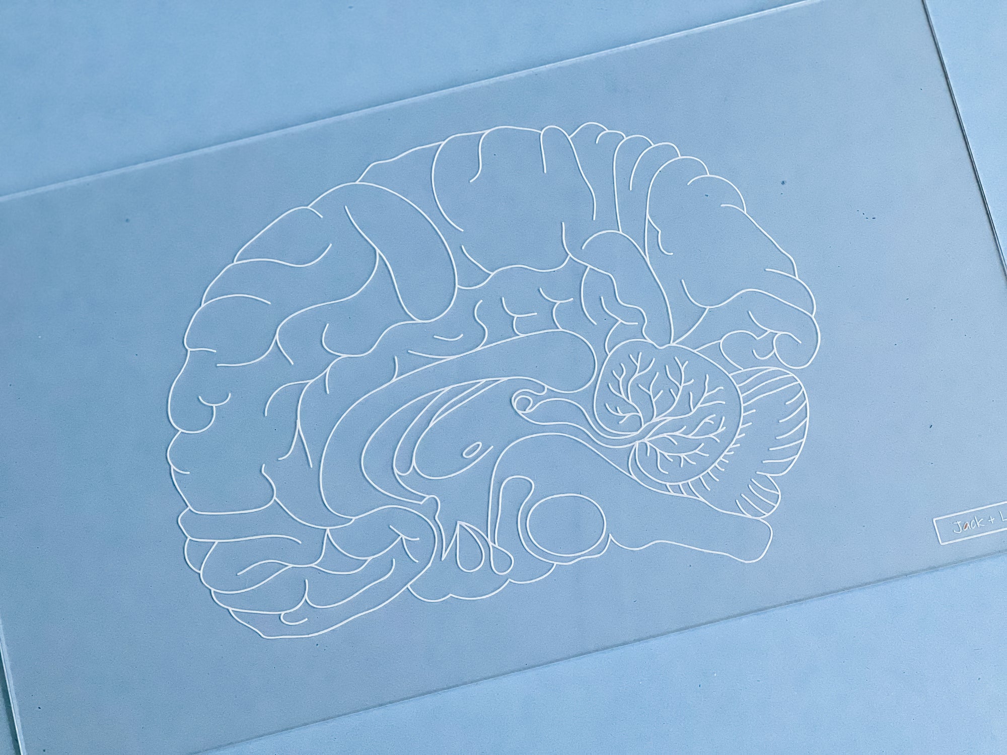 Easy Dry Erase Anatomy Board™ (Brain)